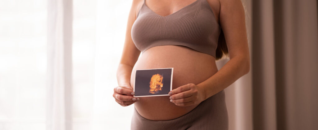 Unrecognizable caucasian pregnant woman holding 3d ultrasound sonogram,photo on baby bump,belly near window, cropped shot,Pastel colours.Natural,healthy,beautiful pregnancy concept.Copyspace for text.